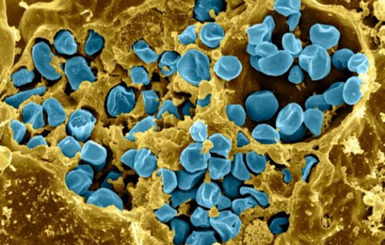 Boulder County Resident Diagnosed with Rare Pneumonic Tularemia, Public Health Officials Issue Warning