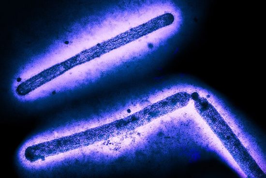 California Child Recovers from Suspected H5N1 Bird Flu with Low Risk of Transmission, Says CDC