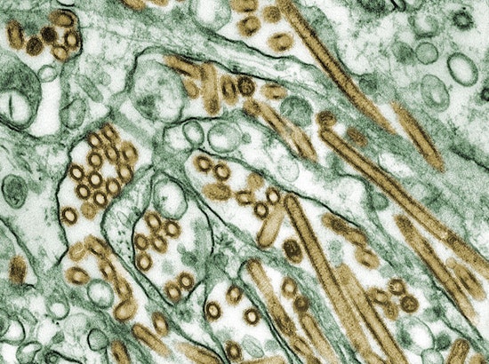 California Health Officials Issue Warning as Bird Flu Detected in Raw Milk, Fresno-Based Raw Farm LLC Initiates Recall
