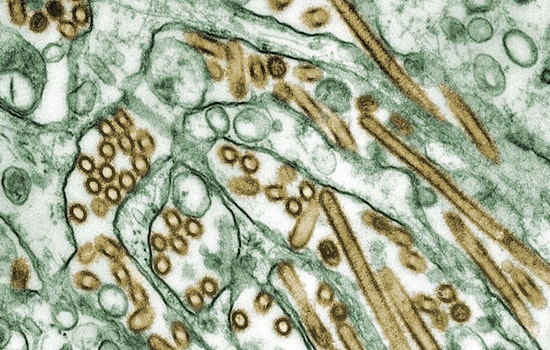 California Health Officials Issue Warning as Bird Flu Detected in Raw Milk, Fresno-Based Raw Farm LLC Initiates Recall