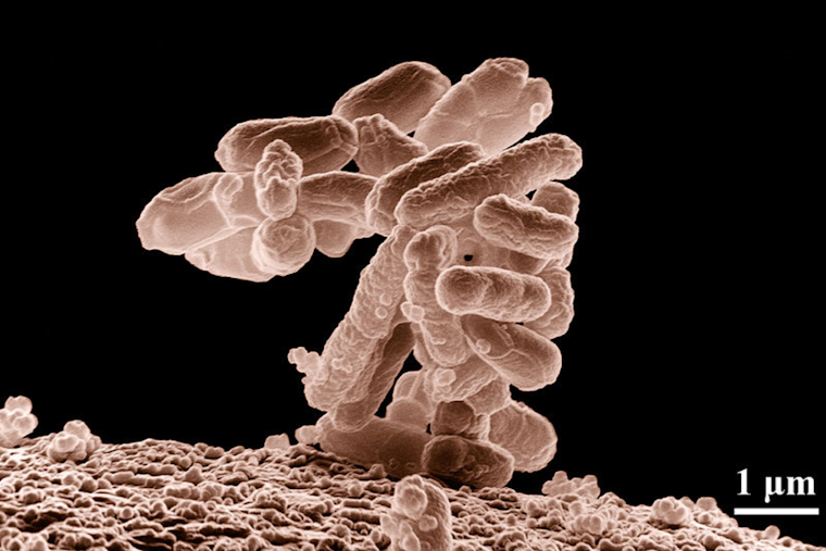 E. Coli Detected in Lower Valley Well, El Paso Water Assures Safety After Prompt Disinfection