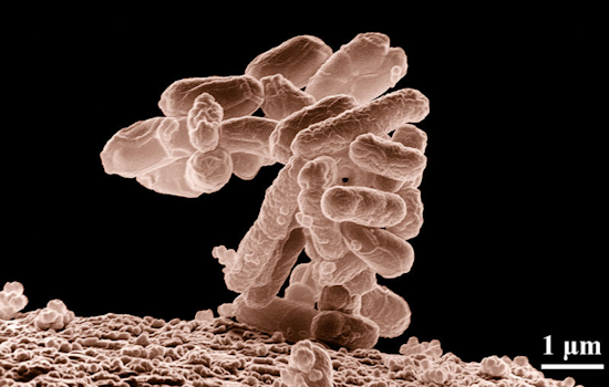 E. Coli Detected in Lower Valley Well, El Paso Water Assures Safety After Prompt Disinfection