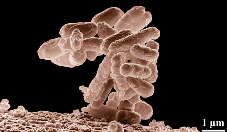 E. Coli Detected in Lower Valley Well, El Paso Water Assures Safety After Prompt Disinfection