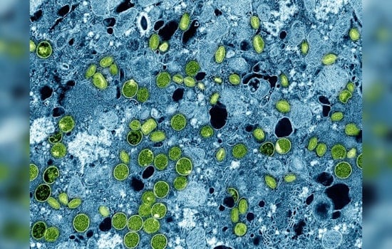 First U.S. Case of New mpox Strain Identified in Northern California, Public Risk Considered Low