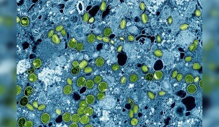 First U.S. Case of New mpox Strain Identified in Northern California, Public Risk Considered Low