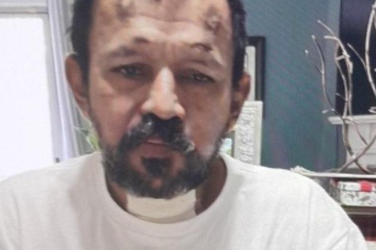 Howard County Police Seek Public Aid in Locating Missing Laurel Man with Memory Issues
