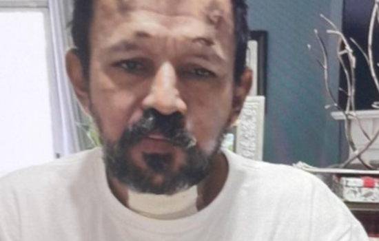 Howard County Police Seek Public Aid in Locating Missing Laurel Man with Memory Issues