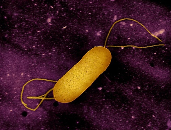 Infant Death in California Linked to Multi-State Listeria Outbreak from Ready-to-Eat Meats by Yu Shang Food Inc.