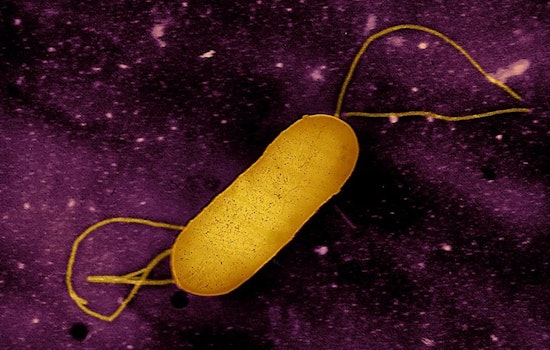 Infant Death in California Linked to Multi-State Listeria Outbreak from Ready-to-Eat Meats by Yu Shang Food Inc.