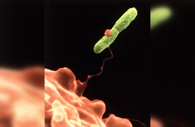 Legionnaires' Disease Cases Rise in Westminster, Orange County Officials Investigate Potential Sources
