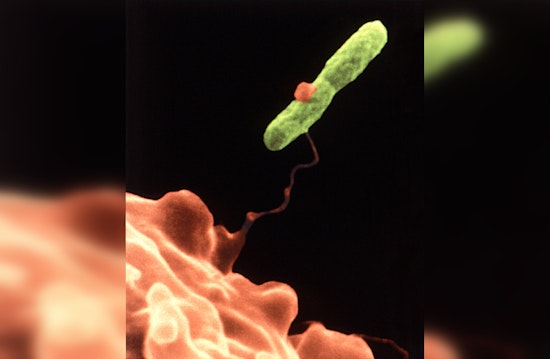 Legionnaires' Disease Cases Rise in Westminster, Orange County Officials Investigate Potential Sources