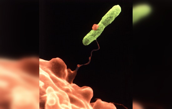 Legionnaires' Disease Cases Rise in Westminster, Orange County Officials Investigate Potential Sources