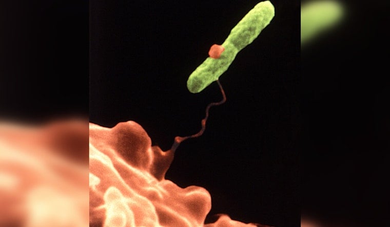 Legionnaires' Disease Cases Rise in Westminster, Orange County Officials Investigate Potential Sources