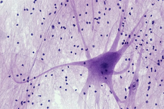MIT Breakthrough, Sweat and Flex Your Way to Neuron Growth, Exercise Unveiled as Key to Brain Cell Boom