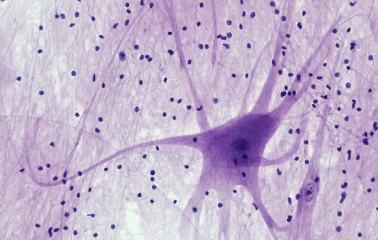 MIT Breakthrough, Sweat and Flex Your Way to Neuron Growth, Exercise Unveiled as Key to Brain Cell Boom