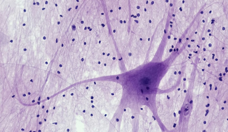 MIT Breakthrough, Sweat and Flex Your Way to Neuron Growth, Exercise Unveiled as Key to Brain Cell Boom