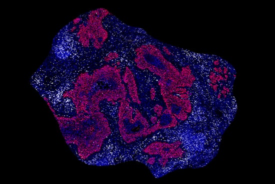 MIT Scientists Unveil Groundbreaking RNA Vaccine in Crusade Against Cancer