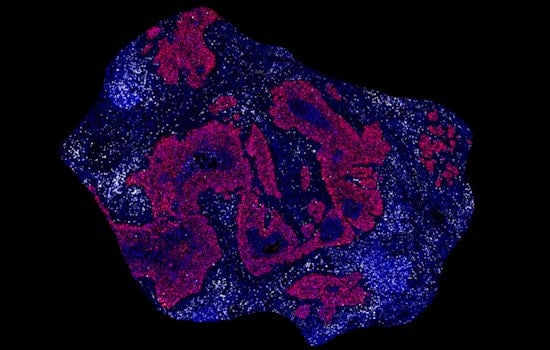 MIT Scientists Unveil Groundbreaking RNA Vaccine in Crusade Against Cancer