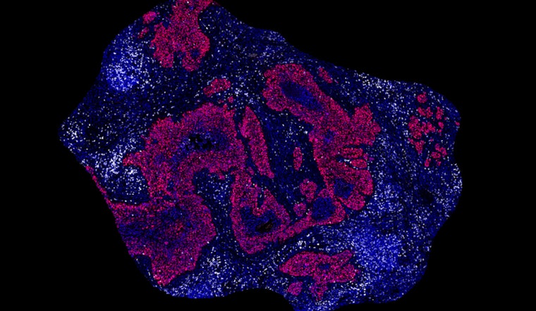 MIT Scientists Unveil Groundbreaking RNA Vaccine in Crusade Against Cancer