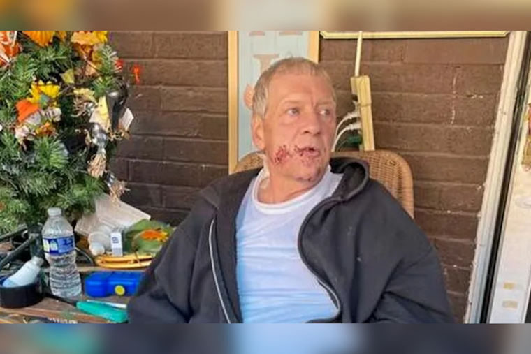 Tarentum Man Charged After Pit Bulls Attack Trick-or-Treaters, Community Rallies to Support Victims