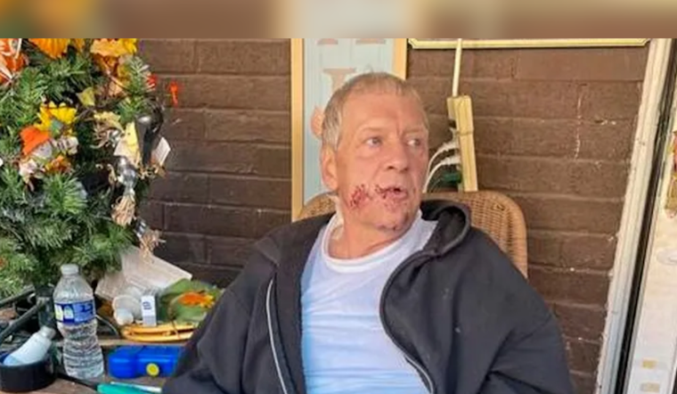 Tarentum Man Charged After Pit Bulls Attack Trick-or-Treaters, Community Rallies to Support Victims