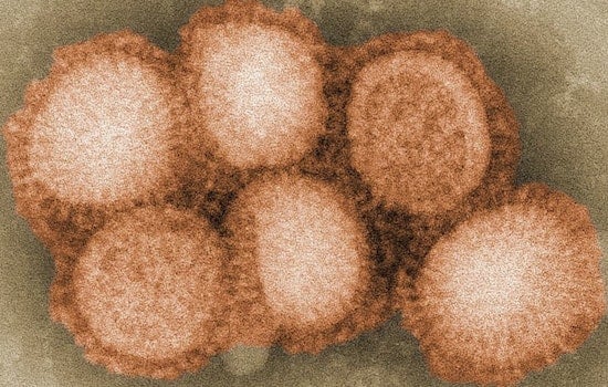Bird Flu Detected in Geese at Scottsdale Park Amid Rising Cases in Arizona