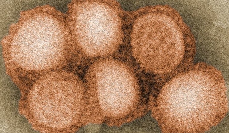 Bird Flu Detected in Geese at Scottsdale Park Amid Rising Cases in Arizona