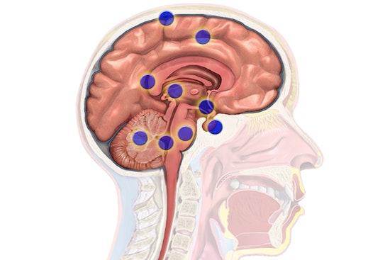 Harvard Study Unveils How Brain Cancers Like Gliomas Recur by Hijacking Neural Networks