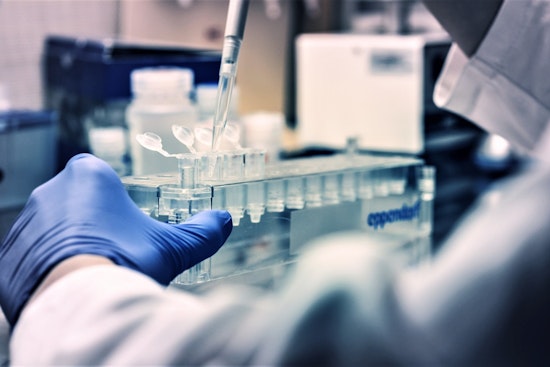 MIT Study Highlights Protein Mobility as Key Factor in Chronic Diseases, Suggests New Therapeutic Targets