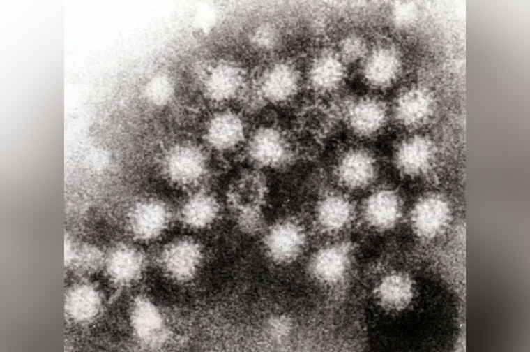 Norovirus Nightmare, CDC Reports Alarming Spike in Outbreaks Across U.S. and Cruises