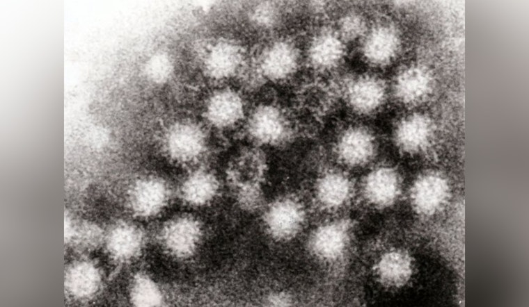 Norovirus Nightmare, CDC Reports Alarming Spike in Outbreaks Across U.S. and Cruises