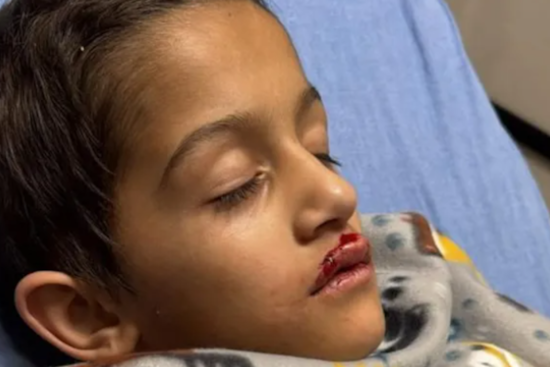 Orlando Boy Recovers After Drone Accident at Holiday Show, FAA Investigates Drone Display Company