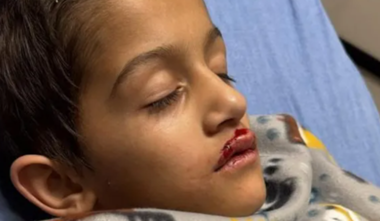 Orlando Boy Recovers After Drone Accident at Holiday Show, FAA Investigates Drone Display Company