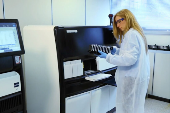 San Diego County Invests $240K in Advanced Medical Equipment to Boost TB Testing Efficiency