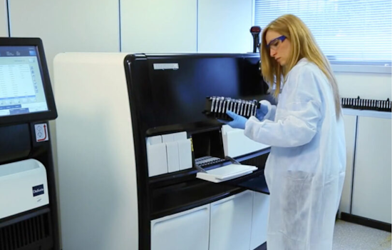 San Diego County Invests $240K in Advanced Medical Equipment to Boost TB Testing Efficiency
