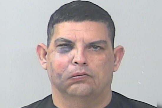 Suspected Drunk Driver Charged After Striking St. Lucie County Officers During Traffic Stop