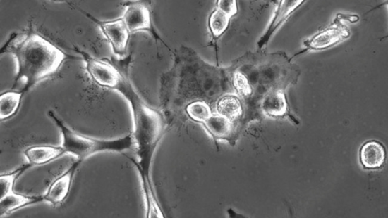 Alabama Babies in Legal Limbo, Court Freezes IVF with Embryo-as-Child Ruling