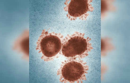 Alaska Reports First Death from Alaskapox Virus as Kenai Peninsula Man Succumbs Amid Cancer Treatment