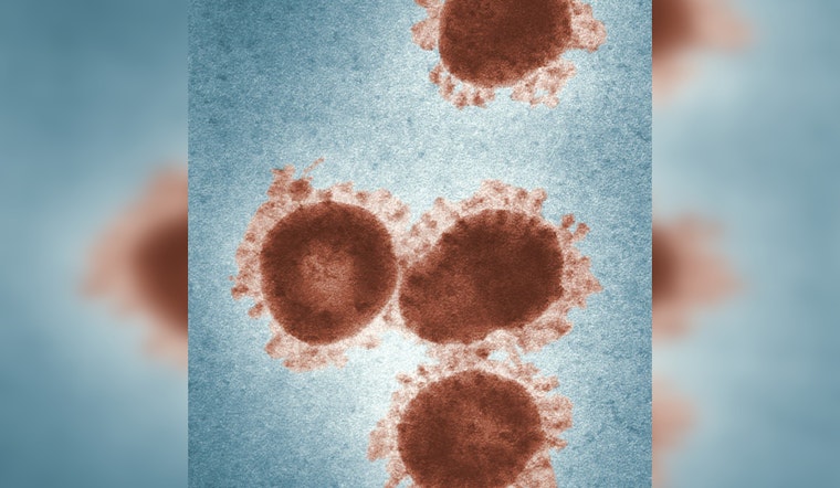 Alaska Reports First Death from Alaskapox Virus as Kenai Peninsula Man Succumbs Amid Cancer Treatment