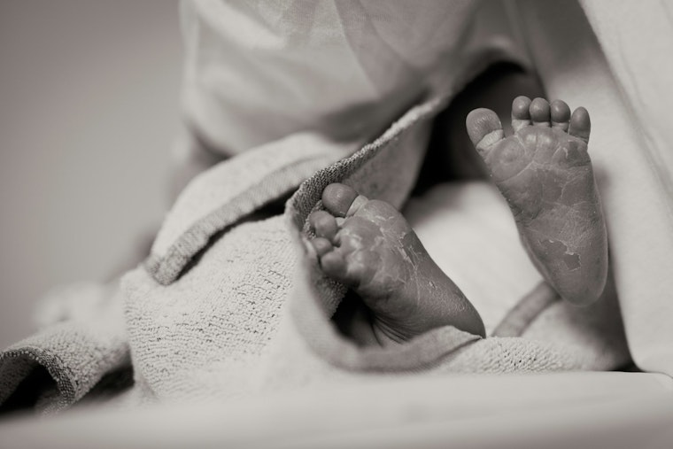 Chicago Battles Surge in Newborn Syphilis Cases, Doubling Rate Raises Alarm