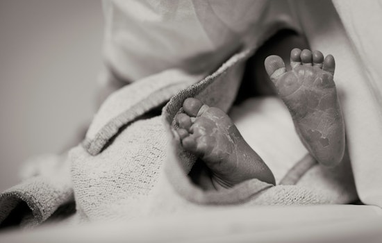 Chicago Battles Surge in Newborn Syphilis Cases, Doubling Rate Raises Alarm