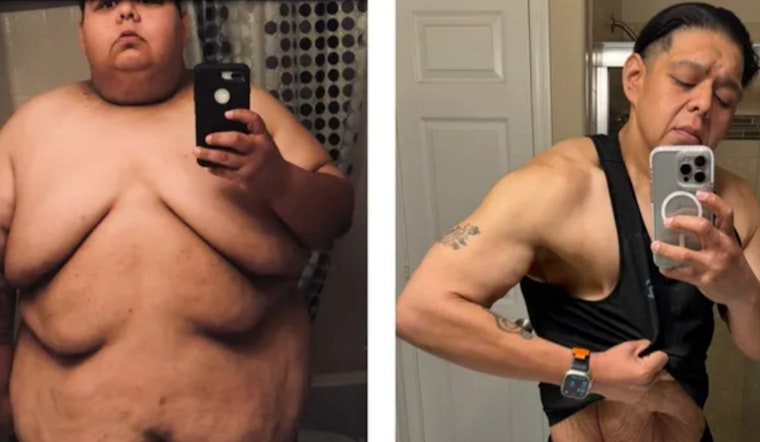 Glendale Man Triumphs Over Obesity and Sparks Inspiration, Crowdfunds for Life-Changing Skin Removal Surgery