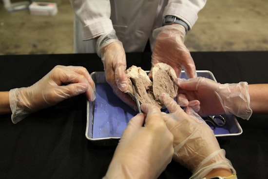 Houston's Health Museum Offers Unique Valentine's Day Dinner and Heart Dissection Experience