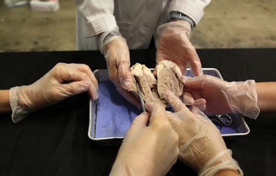 Houston's Health Museum Offers Unique Valentine's Day Dinner and Heart Dissection Experience