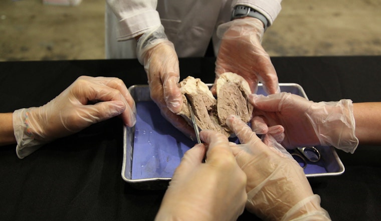 Houston's Health Museum Offers Unique Valentine's Day Dinner and Heart Dissection Experience