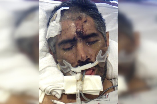 Los Angeles General Medical Center Seeks Help to Identify Mysterious Patient 'John Doe'