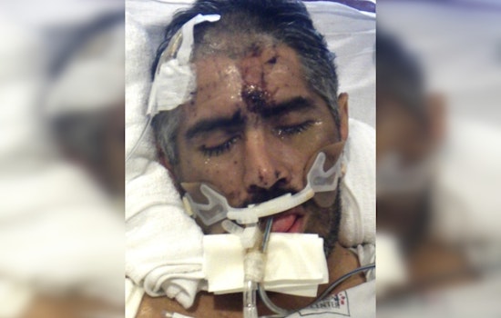 Los Angeles General Medical Center Seeks Help to Identify Mysterious Patient 'John Doe'
