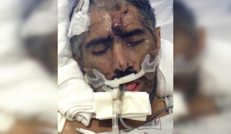 Los Angeles General Medical Center Seeks Help to Identify Mysterious Patient 'John Doe'