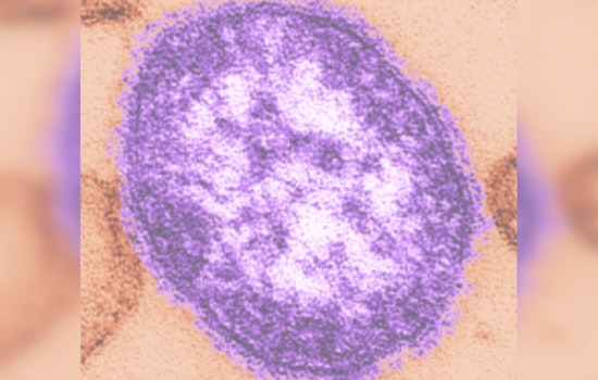 Maricopa County Issues Measles Exposure Alert, Identifies Five Hotspots in Gilbert and Queen Creek