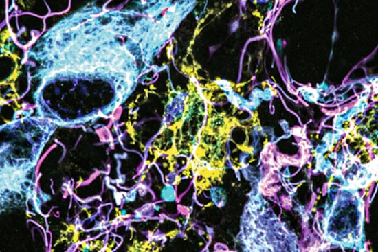 MIT and Brigham Researchers Unveil Breakthrough Brain Tumor Nanoimaging, Poised to Transform Diagnosis and Treatment